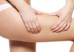 Cellulite et vergetures