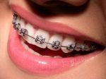 Orthodontie