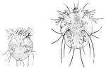 Maladies infectieuses et parasitaires